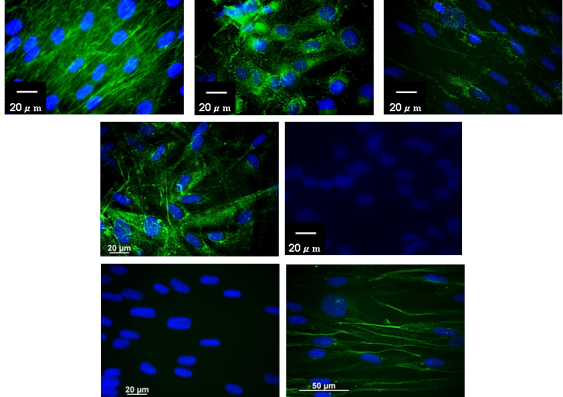Fluorescence images of the team using antibodies as a diagnostic. The blue is the nucleus of cells containing the DNA and the green is the reactivity of different antibodies on cells grown in tissue culture.