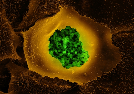 15_human_epithelial_cell_infected_with_chlamydia_trachomatis_zeiss_microscopy_flickr.jpg