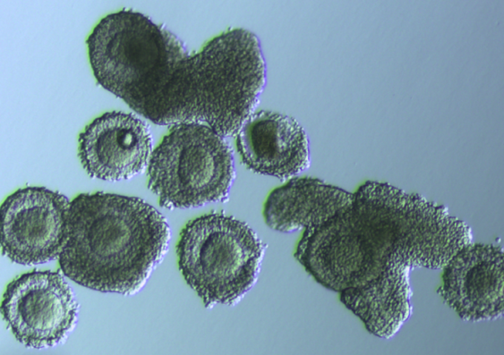 Microscope image of egg cells being matured in cell culture