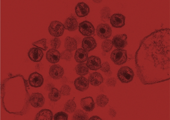 HIV cells