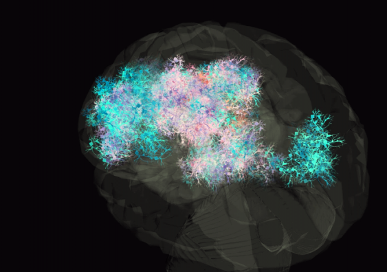 Brain scan showing brain interacting with architecture