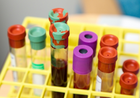 blood awaits testing in vials in a rack