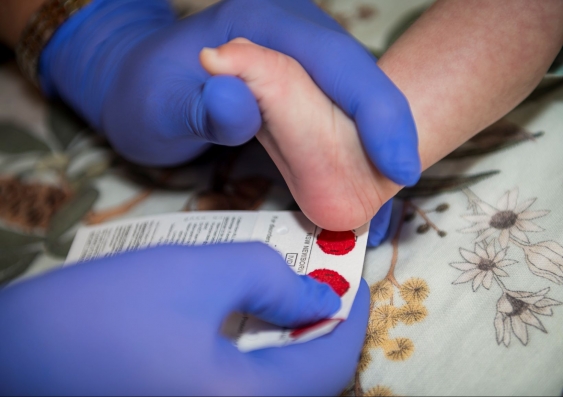 A baby's heel being pressed against paper for the newborn bloodspot screening program
