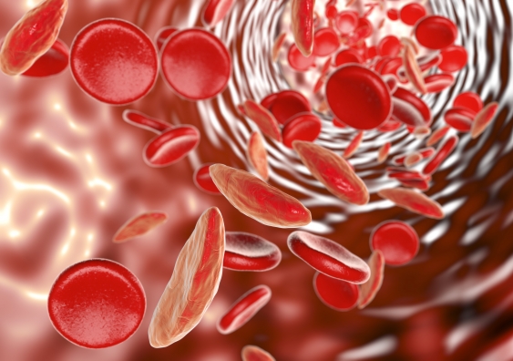 The slow climb from innovation to cure: treating anaemia ...