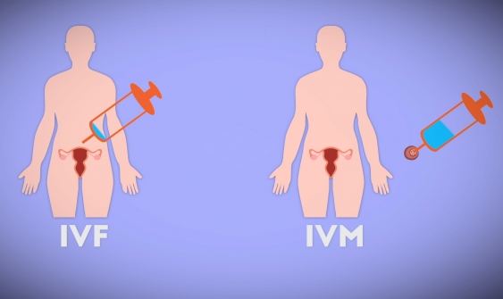 IVF v IVM