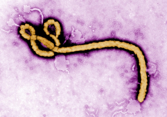 The Ebola virus: scientific uncertainty left front line healthcare workers out on a limb (Photo: CDC Global)