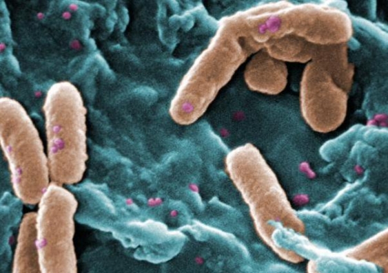 A scanning electron micrograph of Pseudomonas aeruginosa bacteria. Image: Janice Haney Carr/CDC