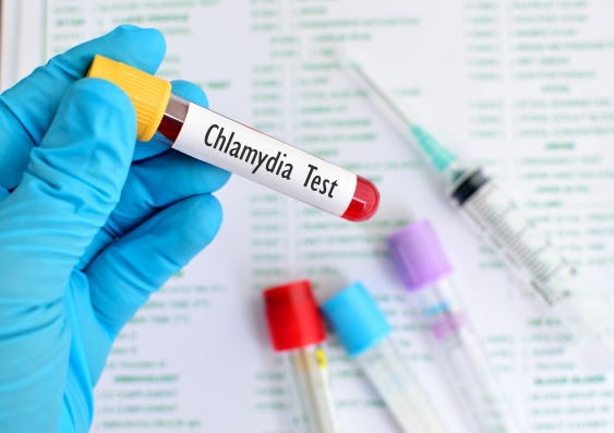 At the end of 2015, there were an estimated 260 000 new cases of chlamydia in 15–29 year olds. The vast majority (72%) of new infections in young people are undiagnosed and therefore untreated. Photo: Shutterstock.