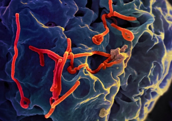 Scanning electron micrograph of Ebola virus budding from the surface of a Vero cell (African green monkey kidney epithelial cell line. NIAID