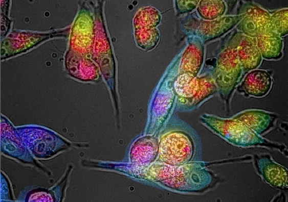 Professor Ewa Goldys and her team used an adapted microscope to capture detailed maps of cells and tissues via a series of photographs. Image: Research coauthor Martin Gosnell Quantitative Pty Ltd.