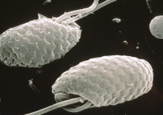 Scanning electron microscope image of cryptophytes. Image: CSIRO