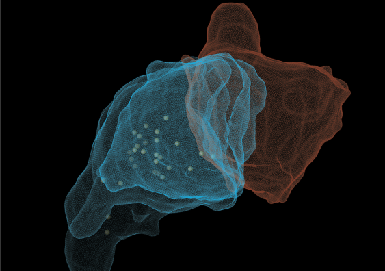 T cells (blue) use physical forces to stretch and bend the membranes of cancer cells (orange). Image: James Cremasco, Daryan Kempe and Maté Biro.