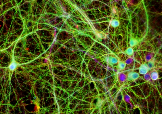 Cultured neurons. The colours highlight the human tau protein in green, a structural component in red and the DNA inside the cell nucleus in blue. Photo: Supplied