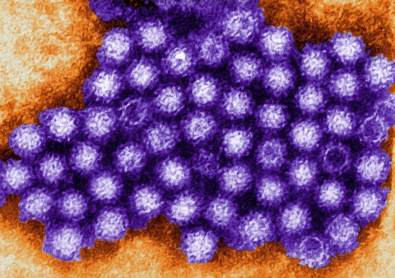 Particles of norovirus