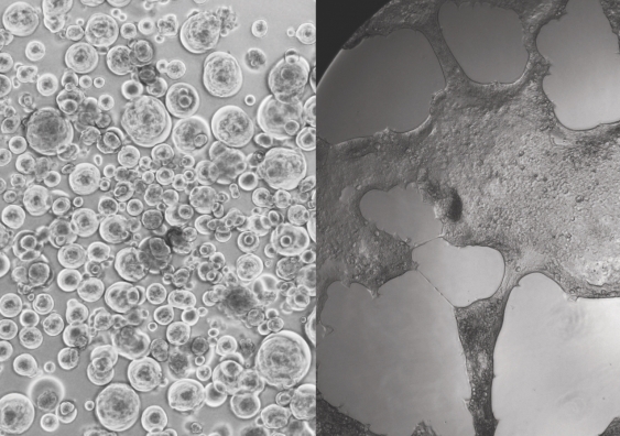 R-20 supercharged cells infected by Delta (left) and Omicron (right). Image: Kirby Institute.