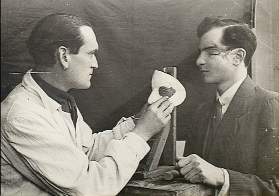 A British medical officer moulds a plate to repair a soldier's face disfigured in the war. Photo: The Australian War Memorial