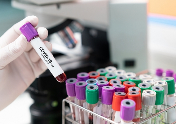 Pooling COVID-19 testing samples together, known as batch testing, could improve efficiency and help keep infection rates lower. Photo: Shutterstock