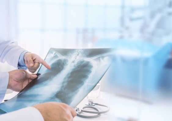 Professor Christine Jenkins said mortality rates have halved as a result of clinical trials that have led to better management of COVID-19 pneumonia and respiratory failure. Image: Shutterstock