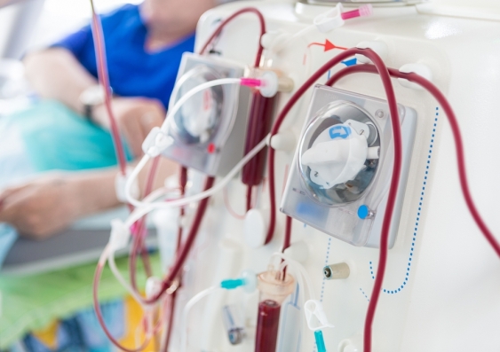 More than 3,000 Australians develop kidney failure requiring dialysis each year and there are currently more than 13,000 Australians receiving dialysis. Photo: Shutterstock