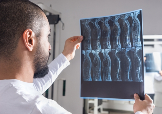 UNSW and NeuRA researchers are leading projects to provide better treatments for people with spinal cord injuries. Image: Shutterstock.