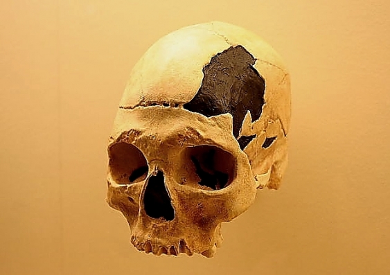 The ~35,000 year old Pestera cu Oase cranium is probably a hybrid between modern humans and Neanderthals. Wikimedia Commons, CC BY-SA