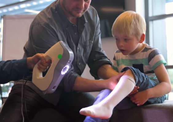 AbilityMate 3D-prints ankle and foot orthoses for children with disabilities. Photo: AbilityMate