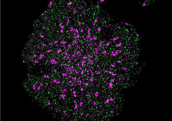 A T cell with precise localisation of T cell receptors (pink) and CD45 phosphatase (green). Image: Single Molecule Science