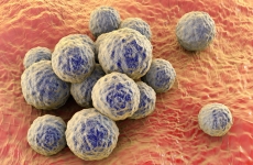 3D illustration of Staphylococcus aureus (MRSA) on the skin.