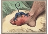 Old-school cartoon showing demon biting an enflamed foot