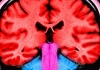Healthy Brain cropped