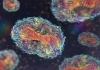 Microscopic images of the monkeypox virus