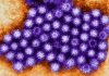 norovirus_1.jpg
