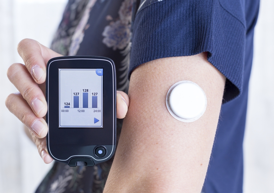 Hoofdkwartier kleding Lokken Flash glucose monitoring: the little patches that can make managing  diabetes a whole lot easier | UNSW Newsroom